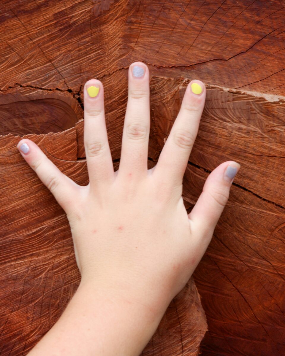 Grickanje noktiju kod djece: zašto se događa i kako pomoći?