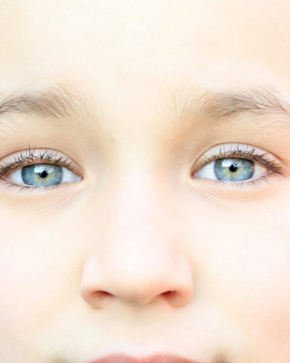 Atopijski dermatitis – kako ga prepoznati kod djece?