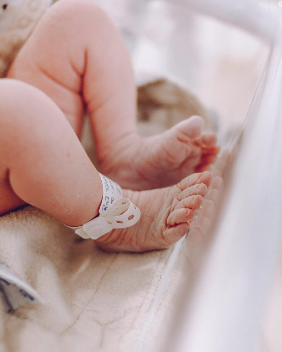 5 znakova da žutica kod bebe zahtijeva pregled liječnika