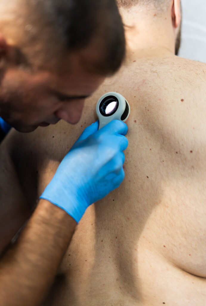 Dermatolog pregledava madeže