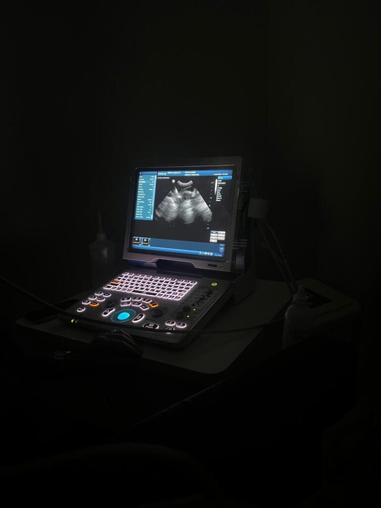 Ultrazvuk